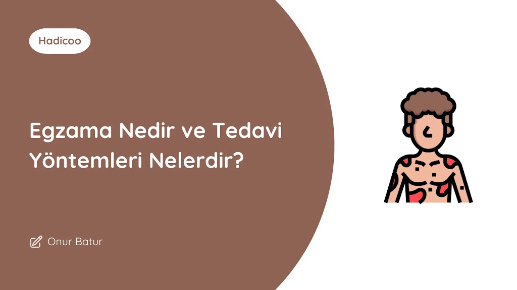 Egzama Nedir ve Tedavi Yöntemleri Nelerdir?